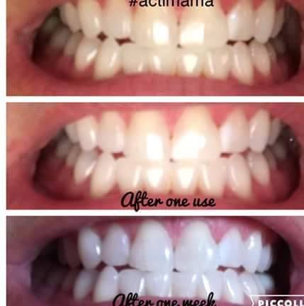 before and after using Diamond Lustre tooth cream