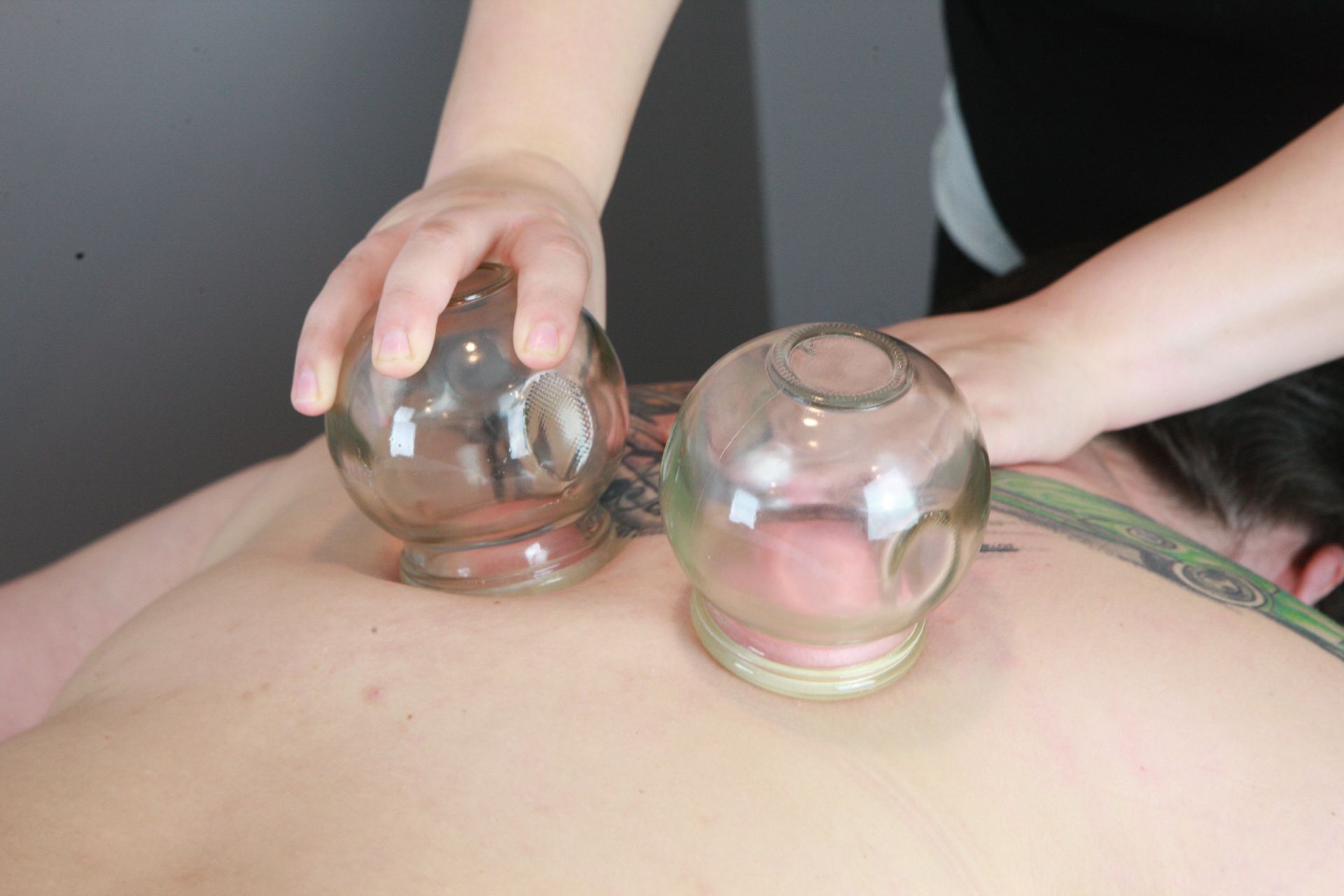 a person is getting a cupping treatment on their back at A Touch of Recovery by Sarah Gillis.