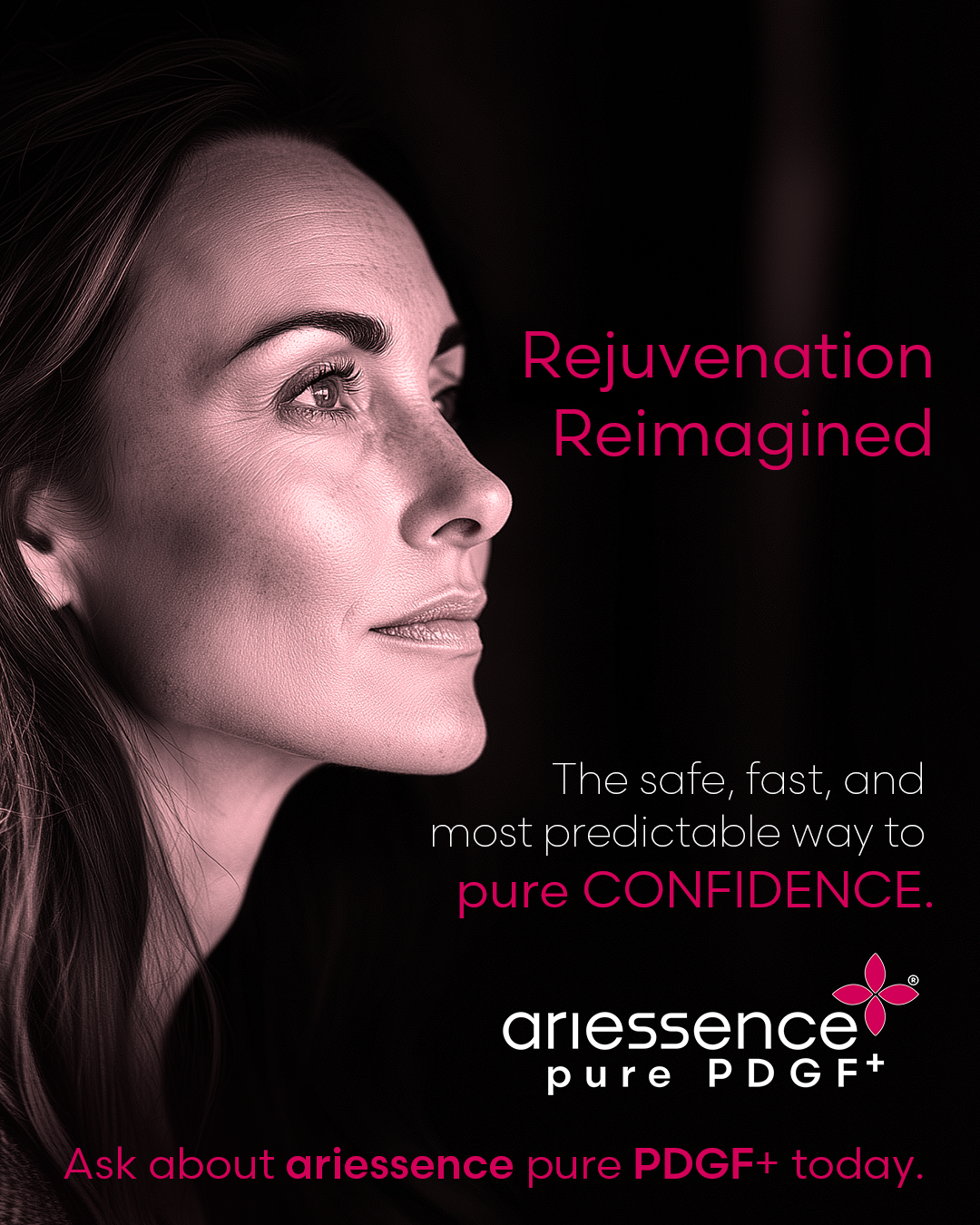 Ariessence Pure PDGF