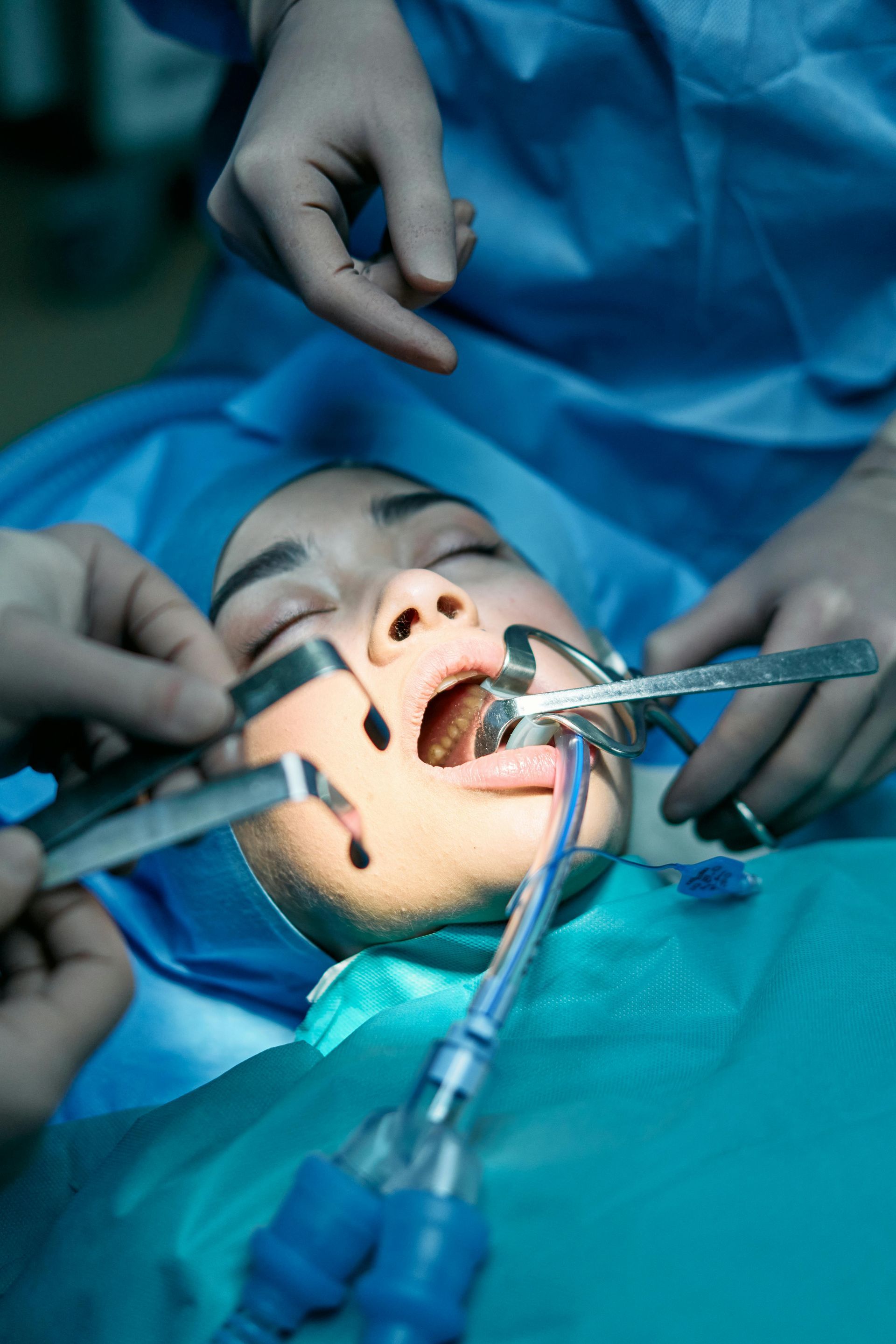 Surgeons in blue scrubs operating on a patient's face in a bright operating room.