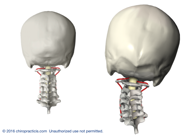 About 3 — Chiropractic Concepts