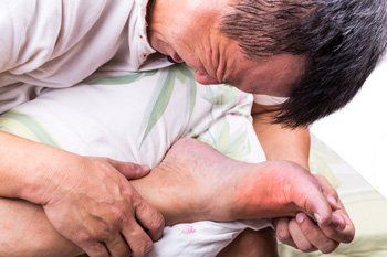 Gout — Man Suffering From Gout in Orlando, FL