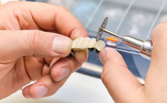 Produzione protesi dentaria