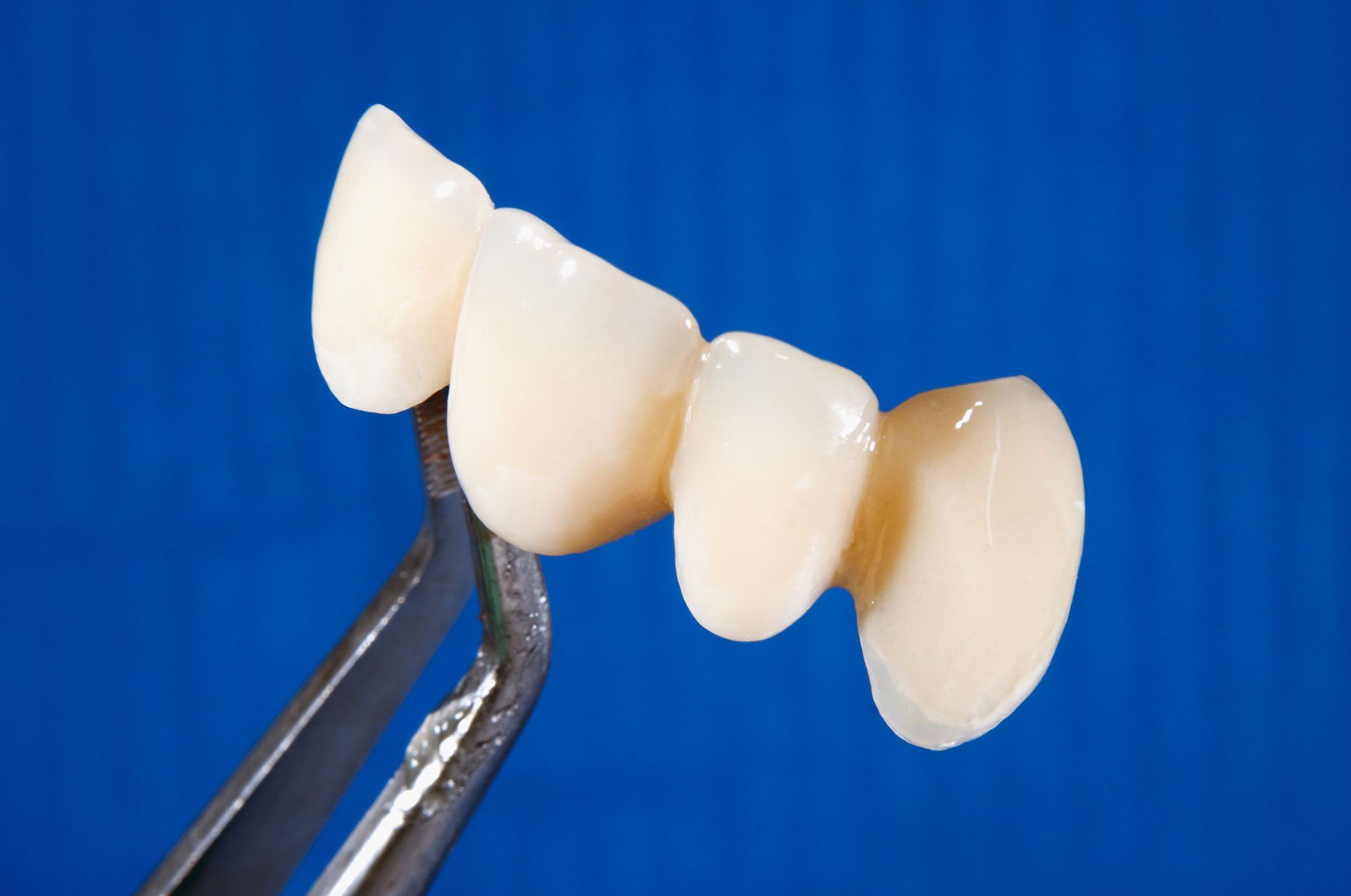 Teeth — Visalia, CA — Halls Gregory Denture Center