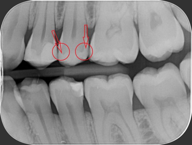 radiografia diagnostica