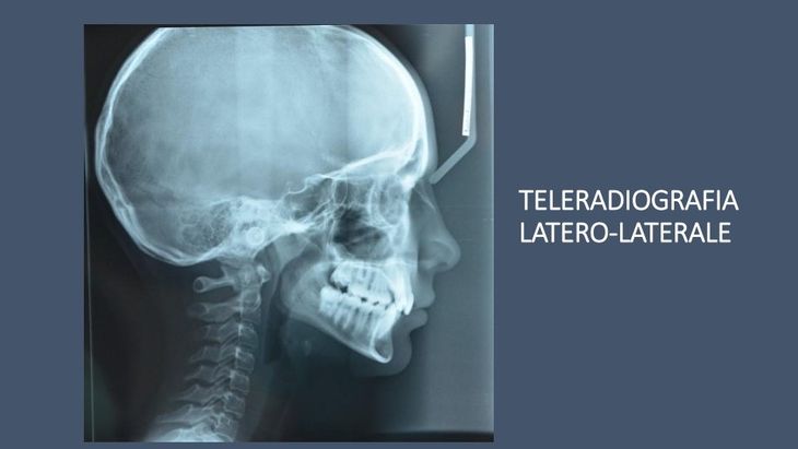 radiografia dentale