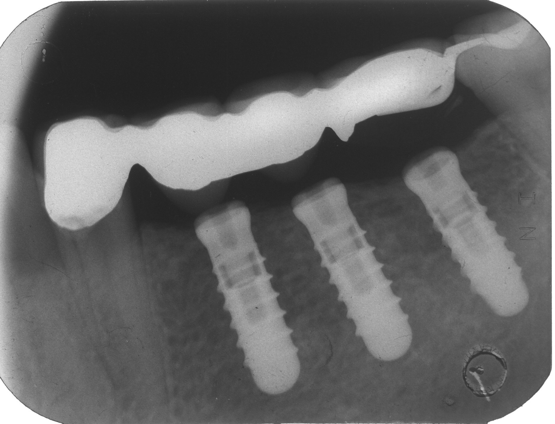 radiografia impianto dentale