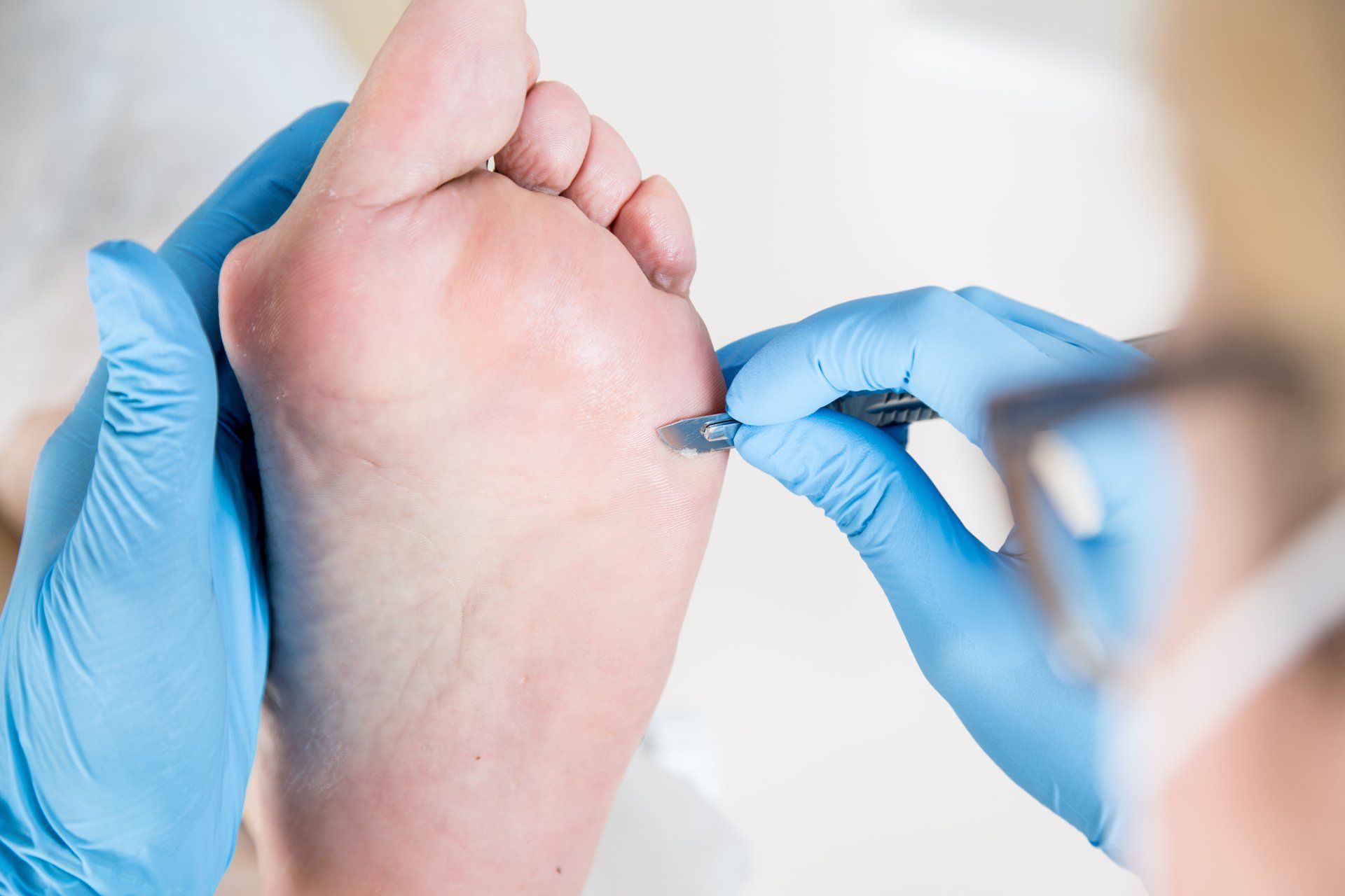 Podiatrist near me in Plym Bridge