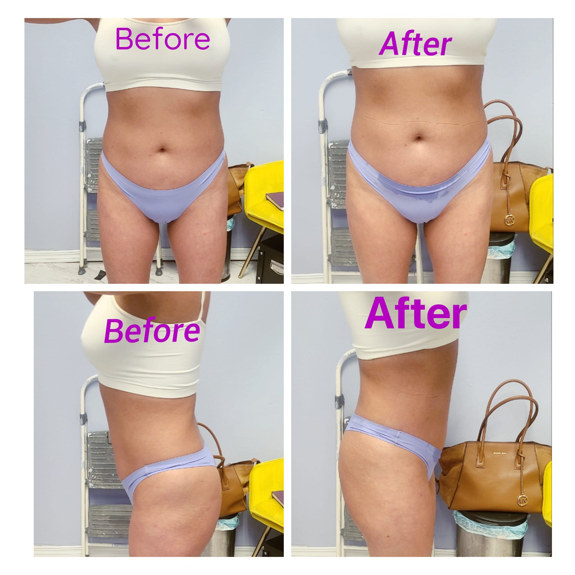 A before and after photo of a woman 's body