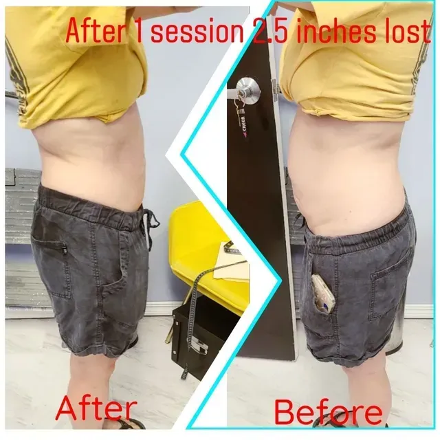 A before and after picture of a person 's stomach