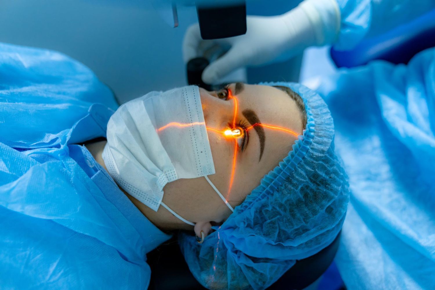 La chirurgie réfractive au laser excimer de surface est une intervention douce et sans découpe, qui