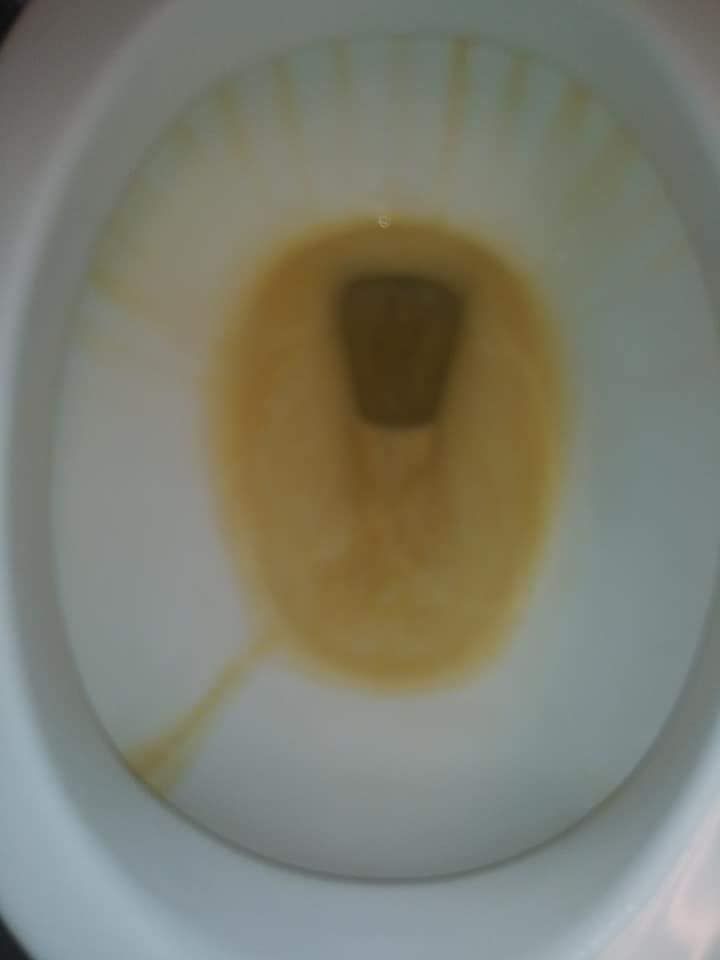 A close up of a toilet bowl with yellow liquid coming out of it.