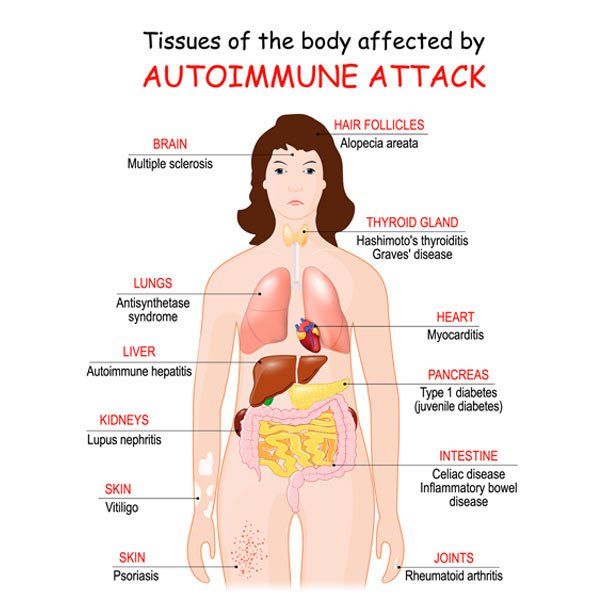 Chart showing  diseases that can be treated. Natural Remedies for Autoimmune Diseases by Board-Certified Nutritional Specialist via Telehealth and from Forest Hills NY 11375
