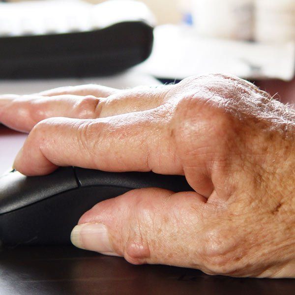 Senior woman with Rheumatoid Arthritis hands
