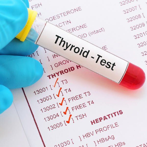 Blood test for Thyroiditis