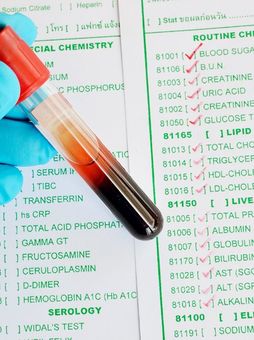 Blood Test Results by Functional Nutritionist NY - Dr. Robert Lichtenstein