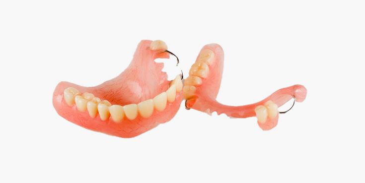 Partial Denture