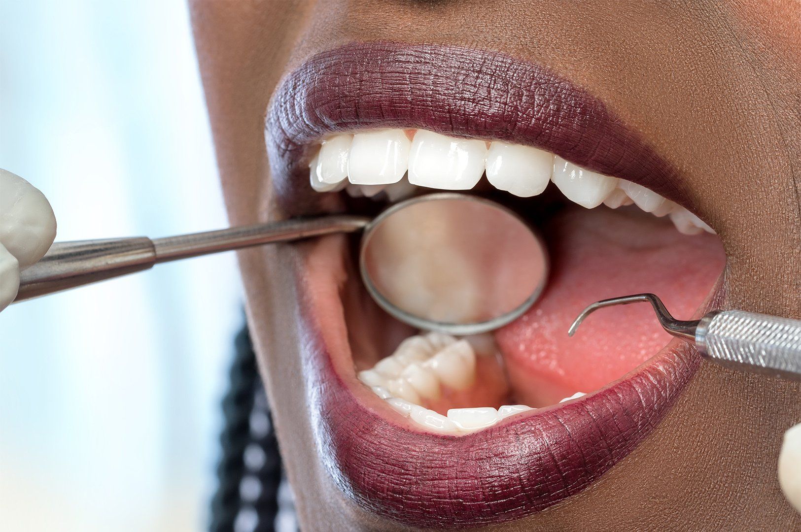 Extreme close up of African woman having dental check up. Open mouth showing perfect white teeth.
