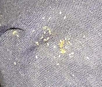 Pictures of Bed Bug eggs
