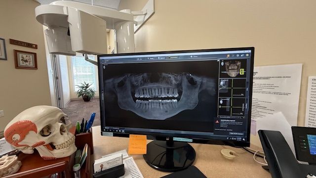 A computer monitor with a picture of a skull on it