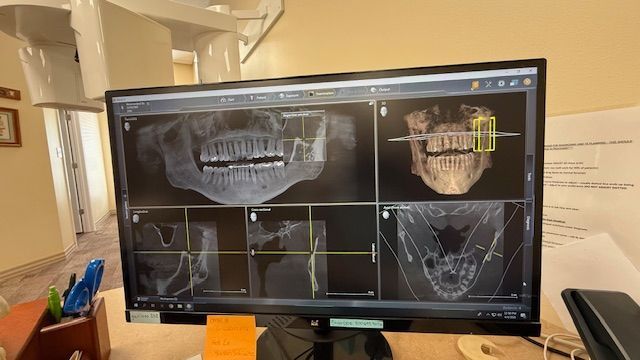 A computer monitor with a picture of a skull on it.