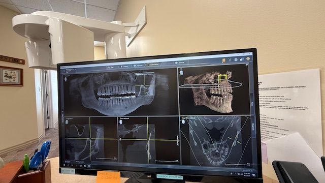 A computer monitor with a picture of a skull on it.