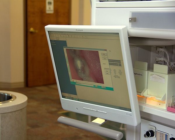 A computer monitor shows a picture of a person 's mouth
