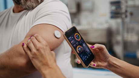 Continuous Glucose Monitoring via an app on a smartphone.