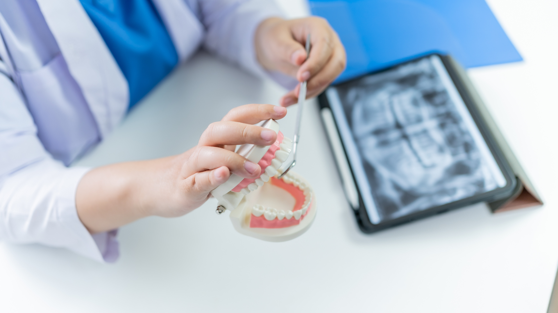Dentist demonstrates brushing technique on a model of teeth next to an X-ray on a tablet.