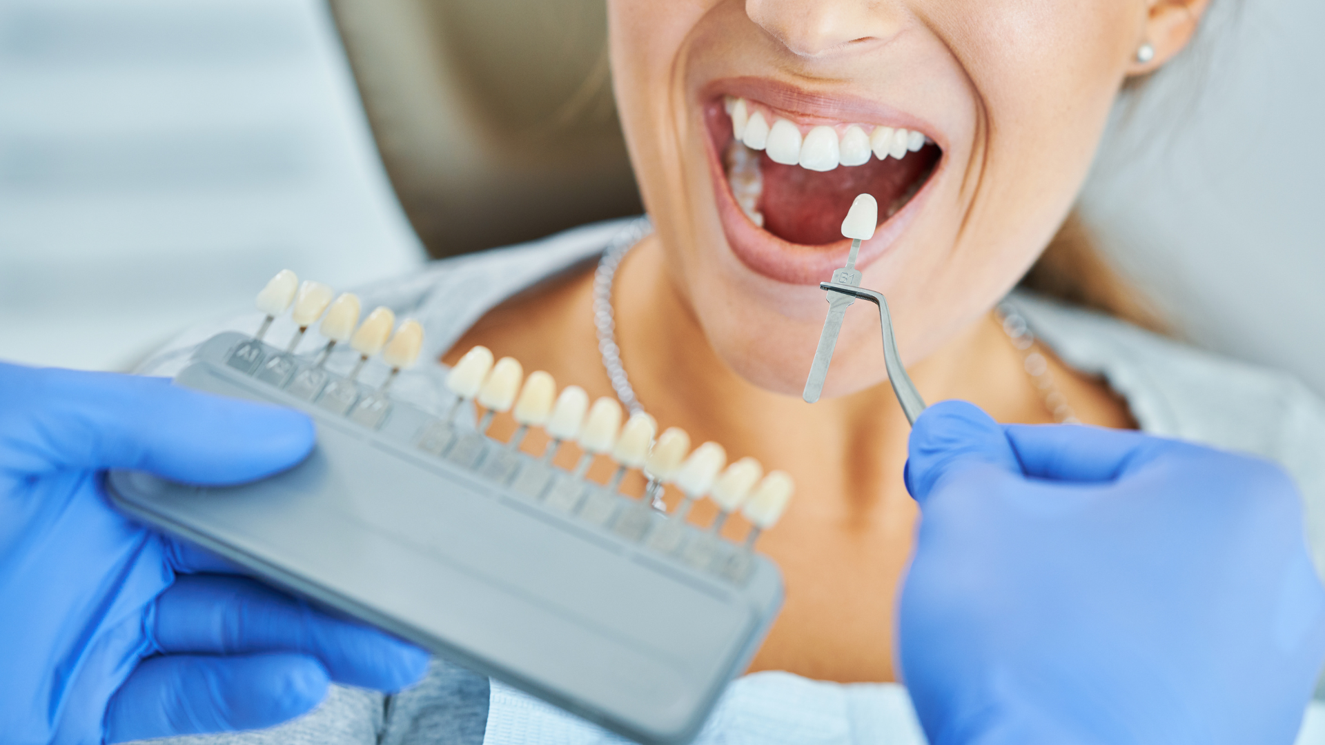 Dentist comparing shade guide to patient's teeth in dental office. Patient smiles, holding mouth open.