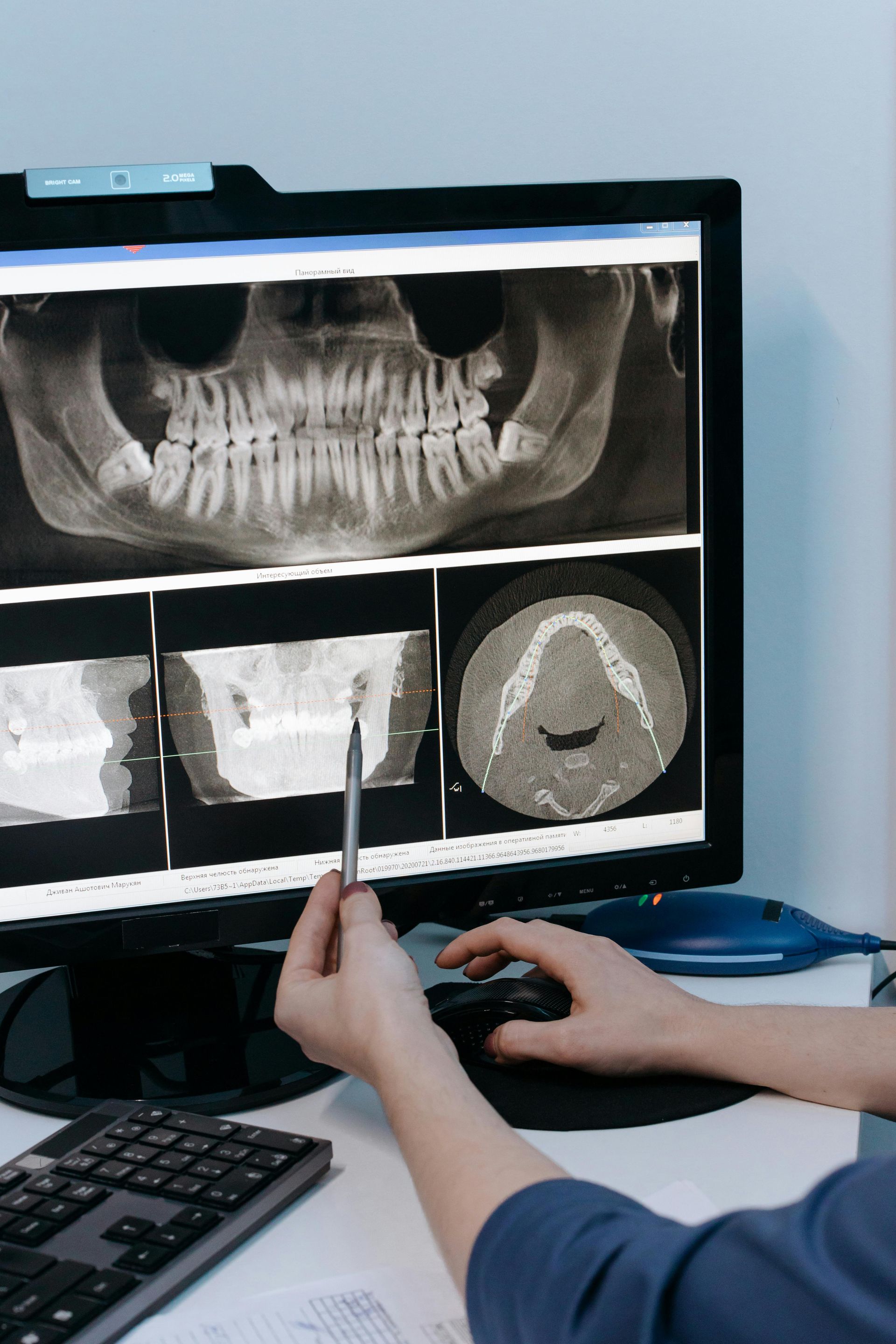 Dentist examining dental X-rays on a computer screen, holding a pen, and using a mouse in an office.
