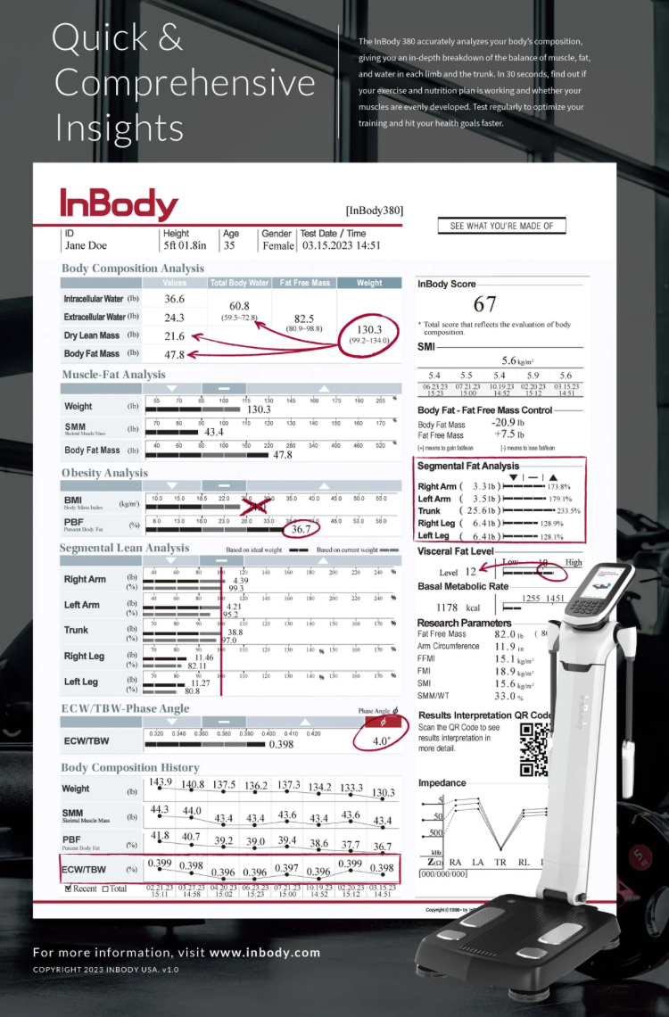 InBody Scan printout and machine