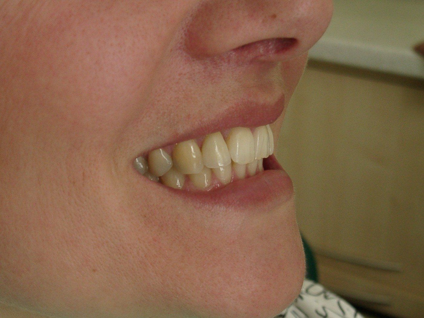 Eine Nahaufnahme vom Mund einer Frau, die ihre Zähne zeigt