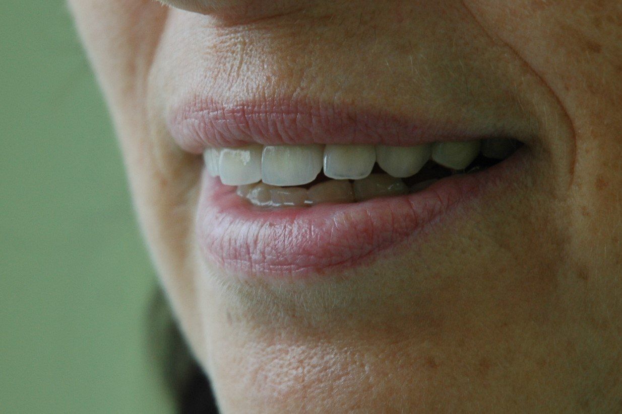 Eine Nahaufnahme des Mundes einer Frau mit weißen Zähnen und rosa Lippen.