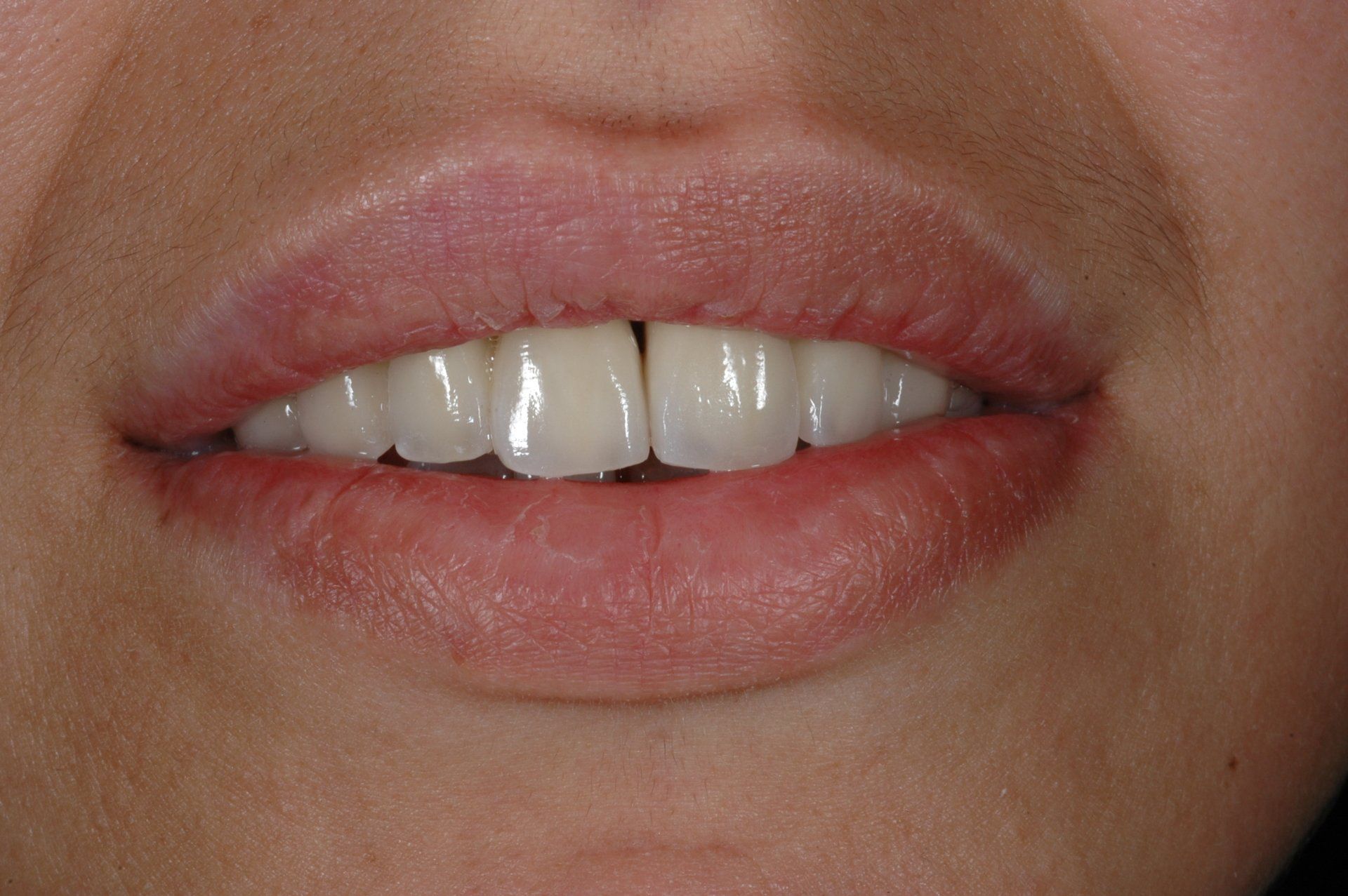 Eine Nahaufnahme des Mundes einer Frau mit weißen Zähnen.