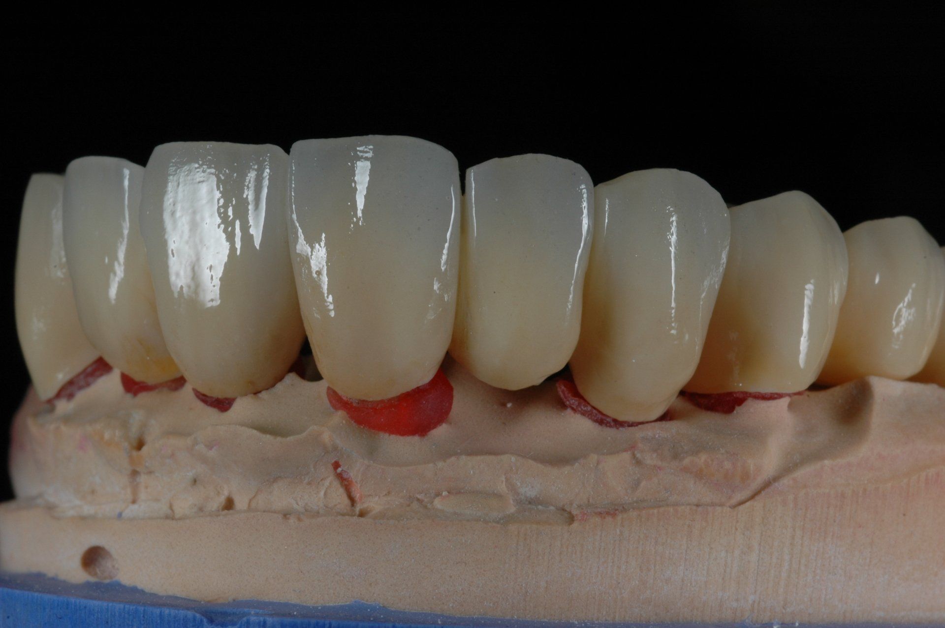 Eine Nahaufnahme eines Gebisses auf einem Modell.