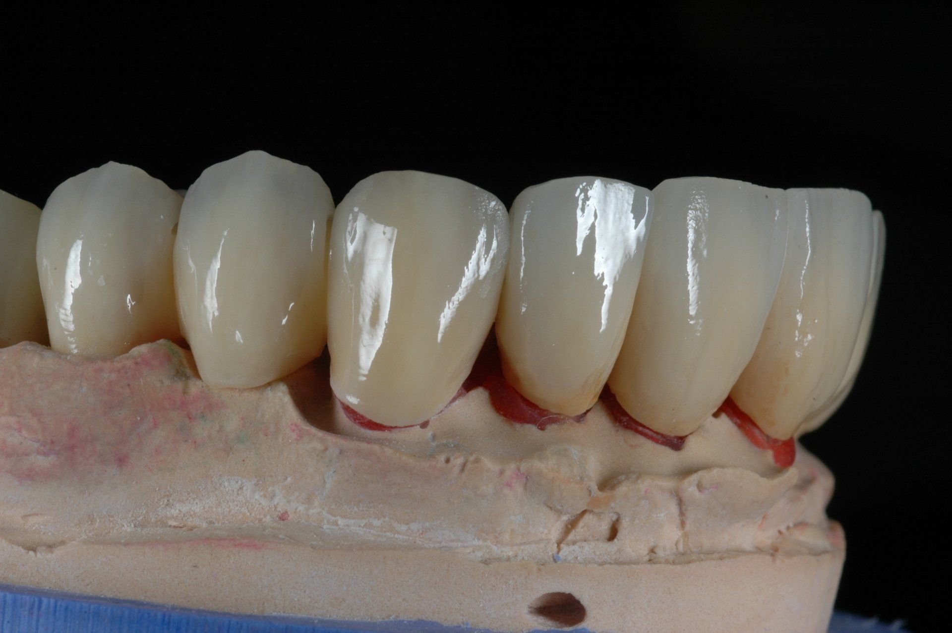 Eine Nahaufnahme eines Modells menschlicher Zähne auf schwarzem Hintergrund.