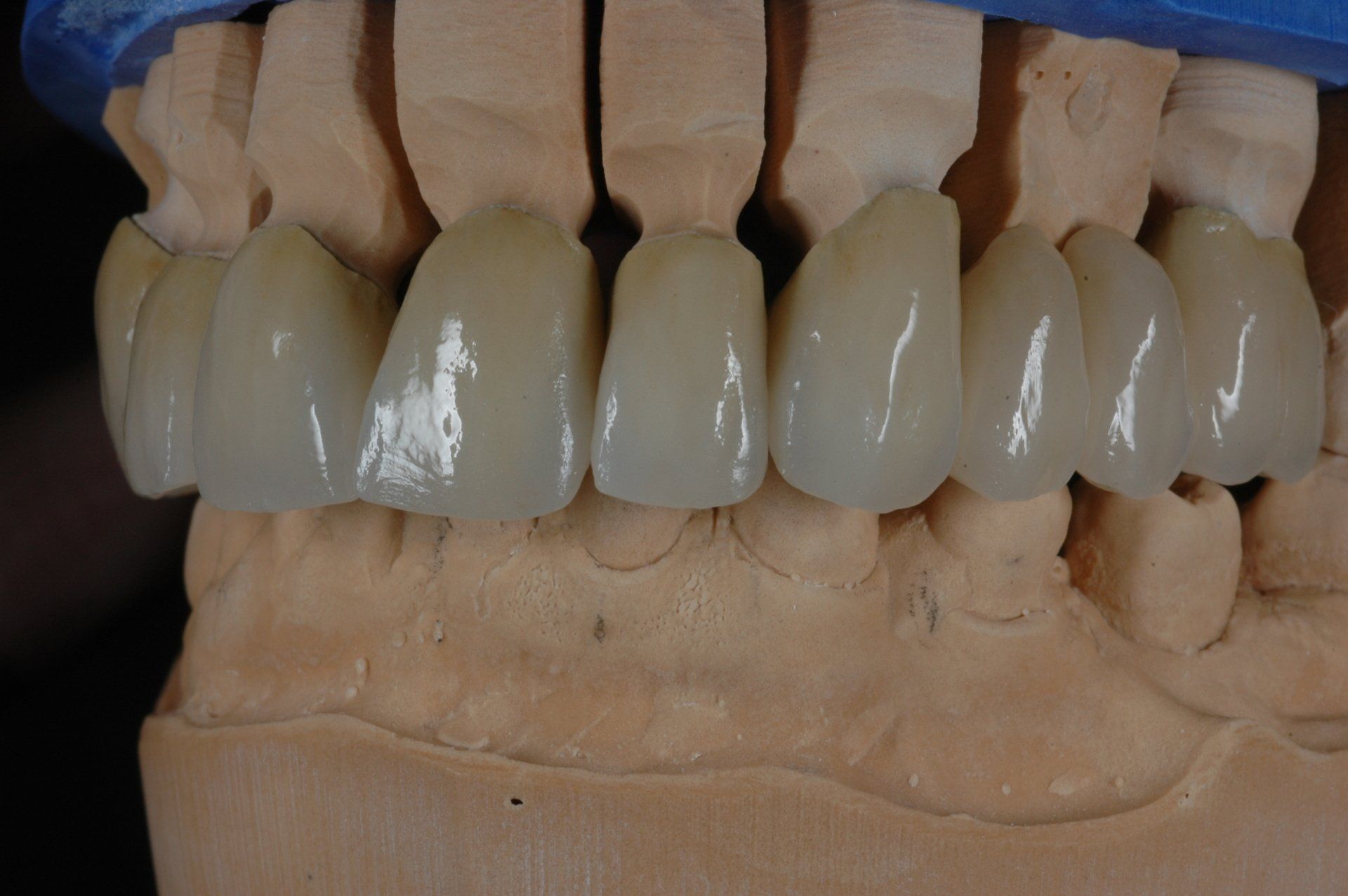 Eine Nahaufnahme eines Modells menschlicher Zähne.