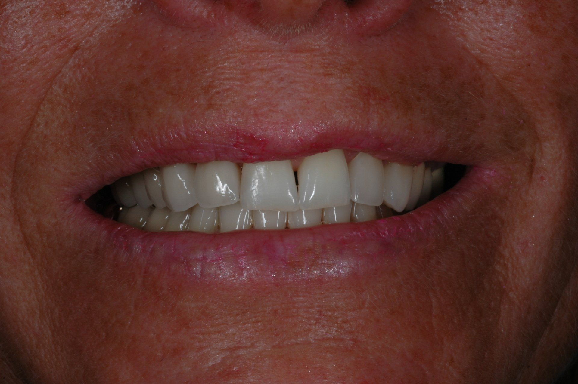 Eine Nahaufnahme des Lächelns einer Frau mit weißen Zähnen.