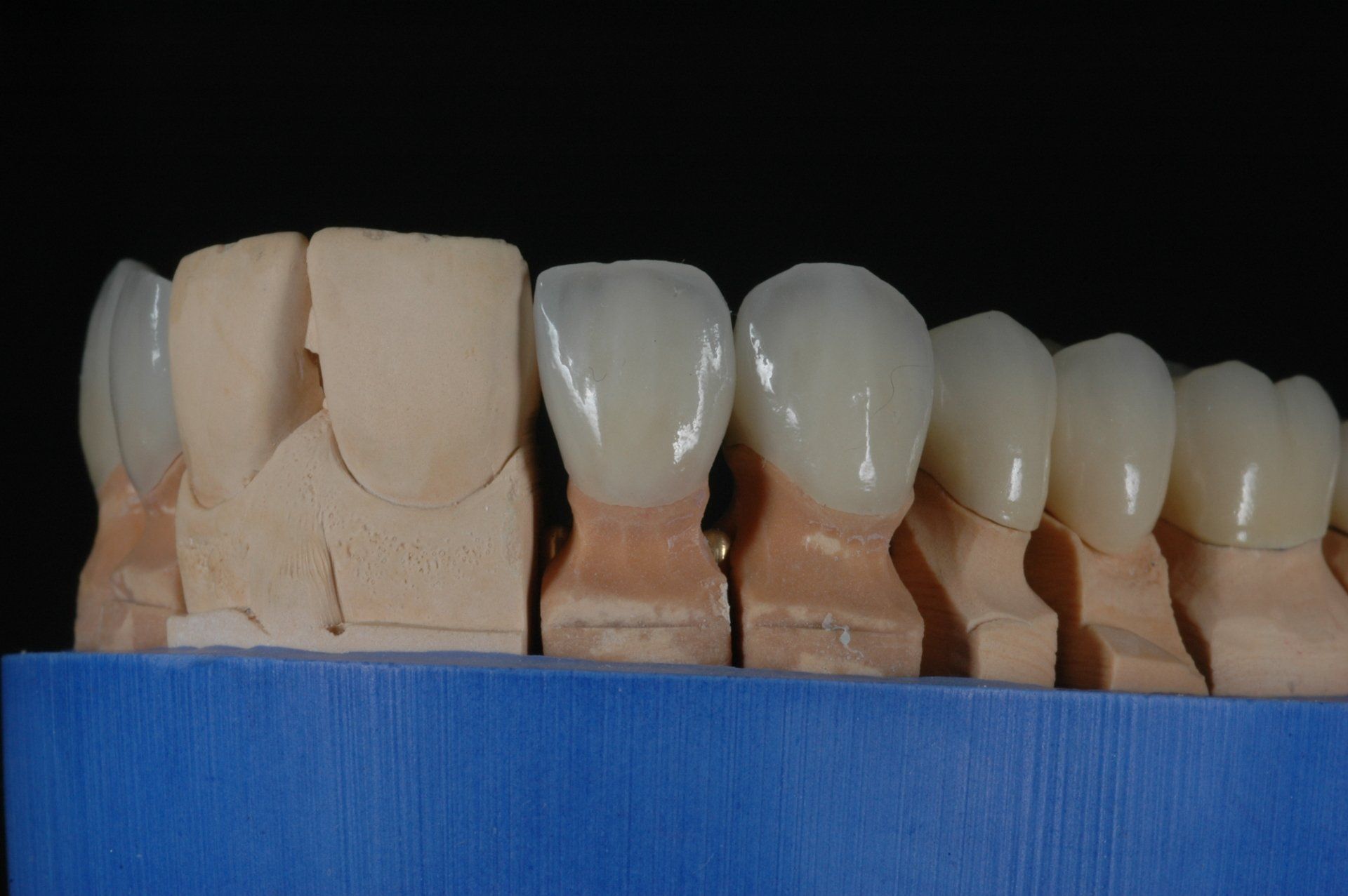 Eine Nahaufnahme eines Modells menschlicher Zähne auf einer blauen Oberfläche.