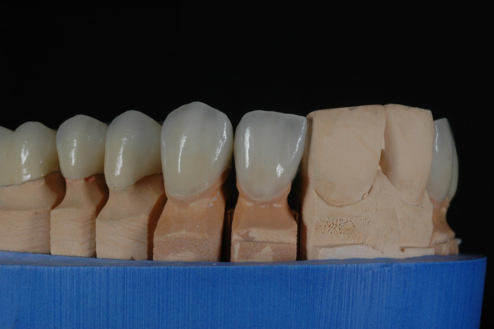 Eine Nahaufnahme einer Zahnreihe auf einem blauen Block.