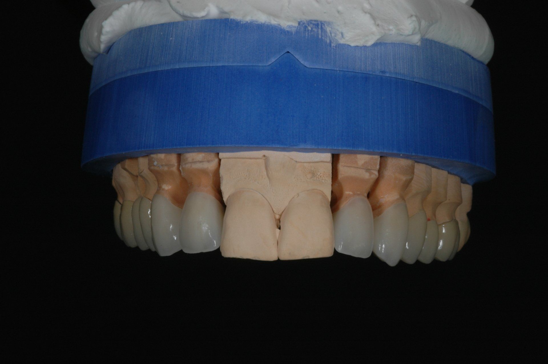Eine Nahaufnahme eines Modells menschlicher Zähne auf schwarzem Hintergrund.