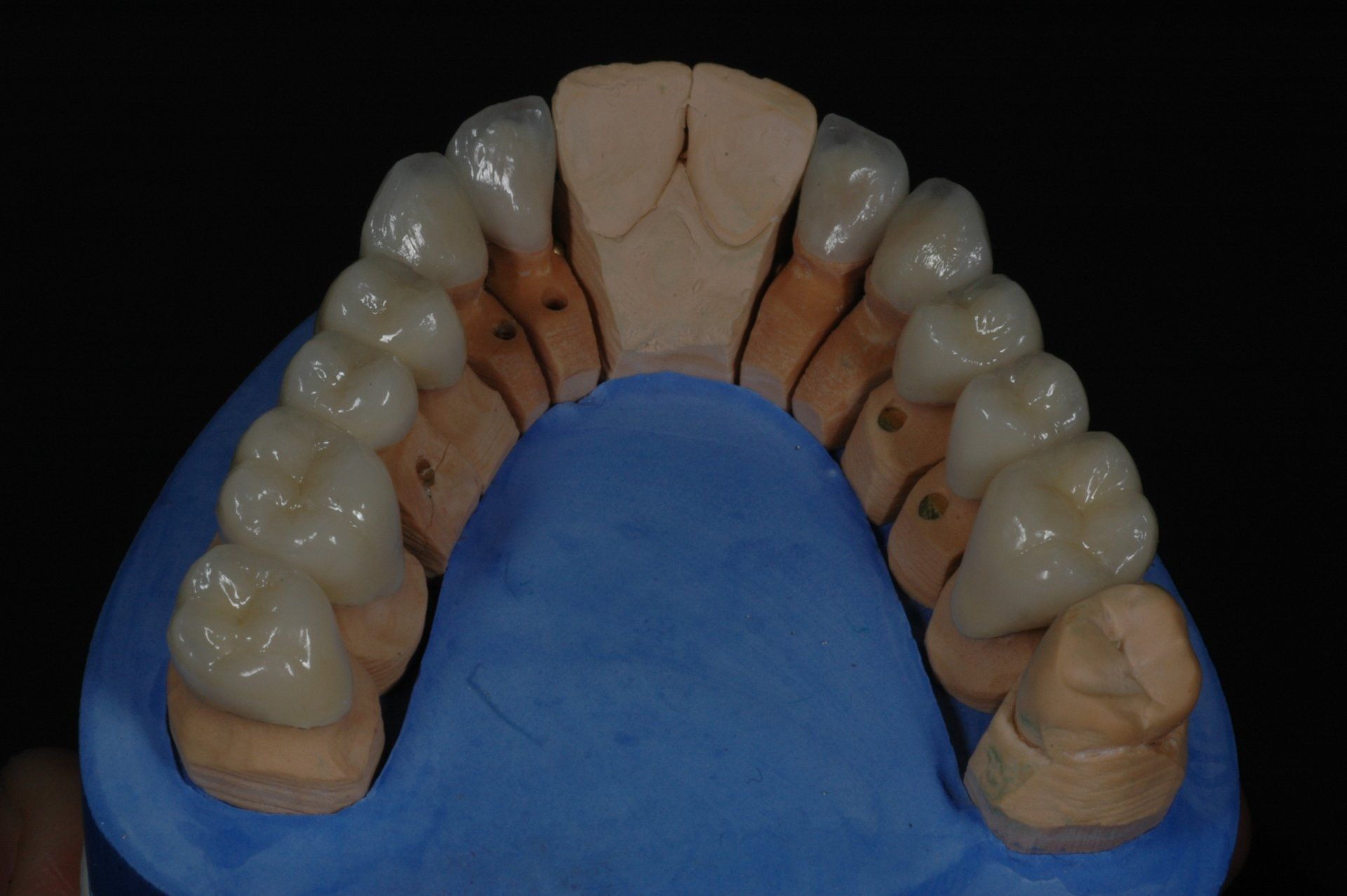 Eine Nahaufnahme eines Modells menschlicher Zähne auf einer blauen Oberfläche.