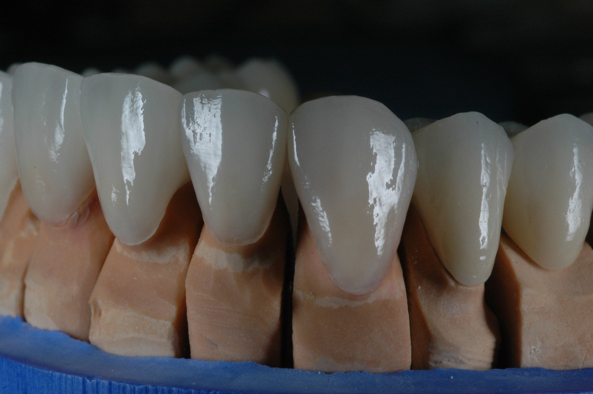 Eine Nahaufnahme eines Modells menschlicher Zähne auf einer blauen Oberfläche.