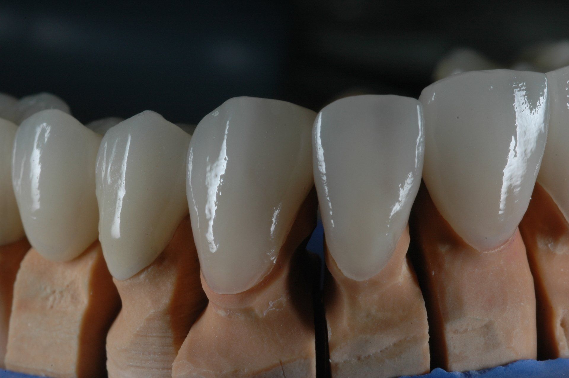 Eine Nahaufnahme eines Modells menschlicher Zähne.