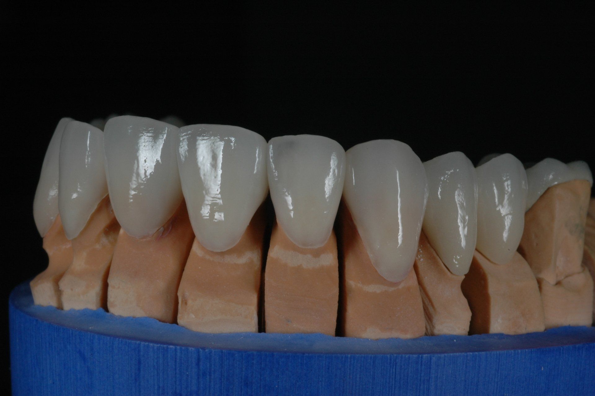 Eine Nahaufnahme eines Modells menschlicher Zähne auf einer blauen Oberfläche.
