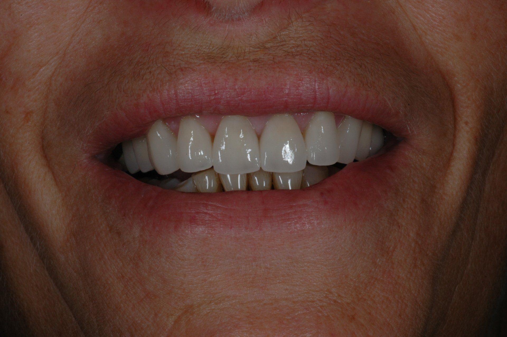 Eine Nahaufnahme des Mundes einer Frau mit weißen Zähnen.