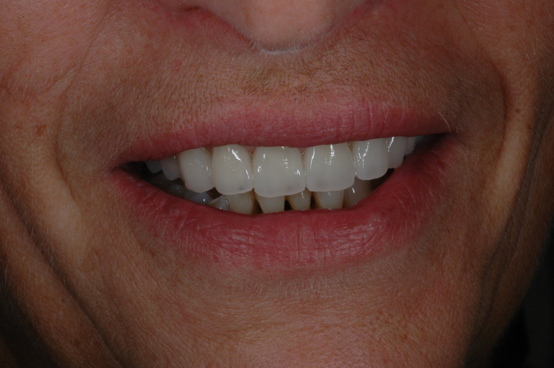 Eine Nahaufnahme des Mundes einer Person mit weißen Zähnen.