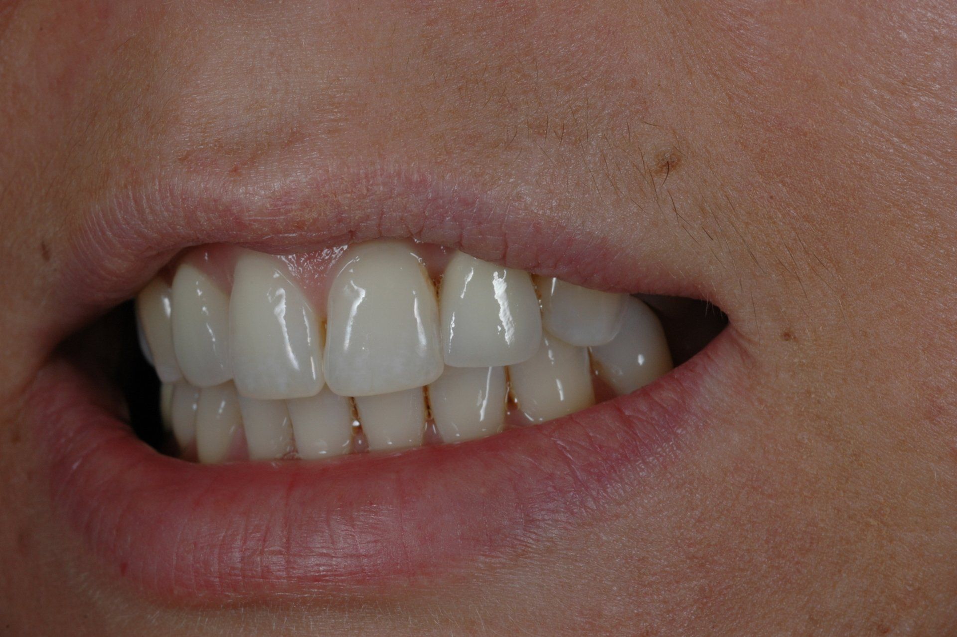 Eine Nahaufnahme des Mundes einer Frau mit weißen Zähnen.