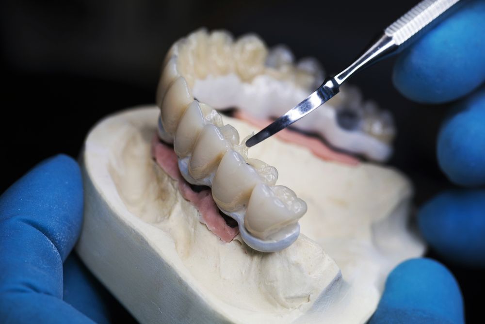 A dentist is working on a model of a person 's teeth — Mittagong Dental Care In Mittagong, NSW